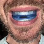 DAWZE NightHush™ – Comfort-Fit Anti-Snoring Mouthpiece